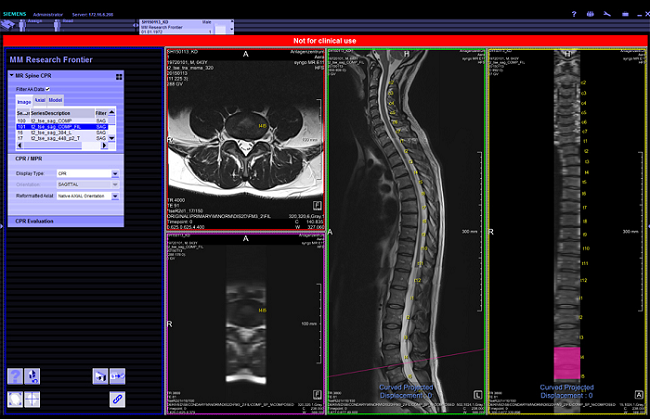 Materialise宣布与西门子合作推广3D打印解剖模型软件