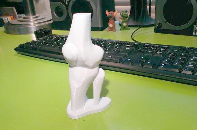 昆医附一院今年已实施11例3D打印置换人工膝关节手术