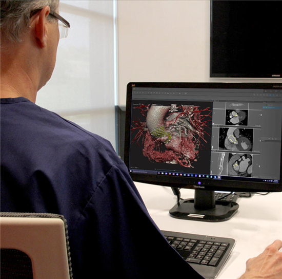 3D Systems推出D2P虚拟现实技术 助力精准医疗