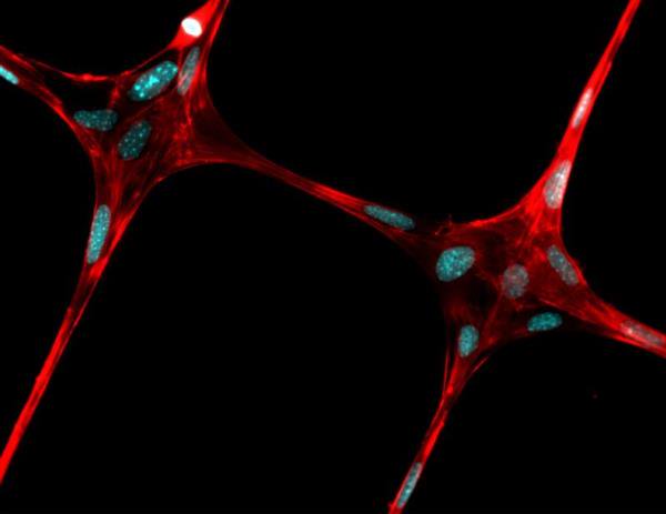美国科学家开发一种生物3D打印方法，用于组织生长微纤维支架