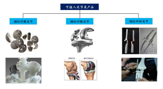 强强联合！广州华钛三维正式切入碳纤维医疗应用领城