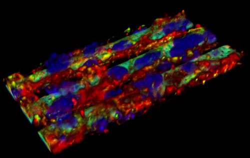医学研究又一重大进步！3D打印仿生血脑屏障无需动物测试