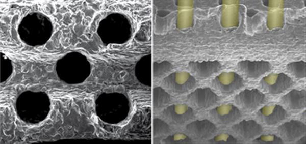 脊椎病患者的福音！K2M推出新的CAPRI颈椎3D可扩展笼式系统
