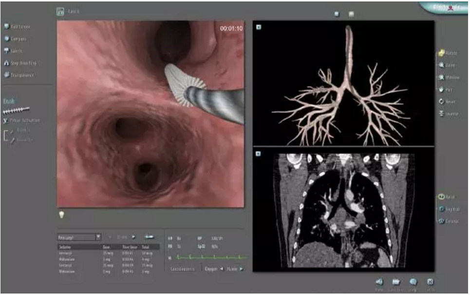 3D Systems联手美国胸科医师学会一起研发支气管镜检标准化课程