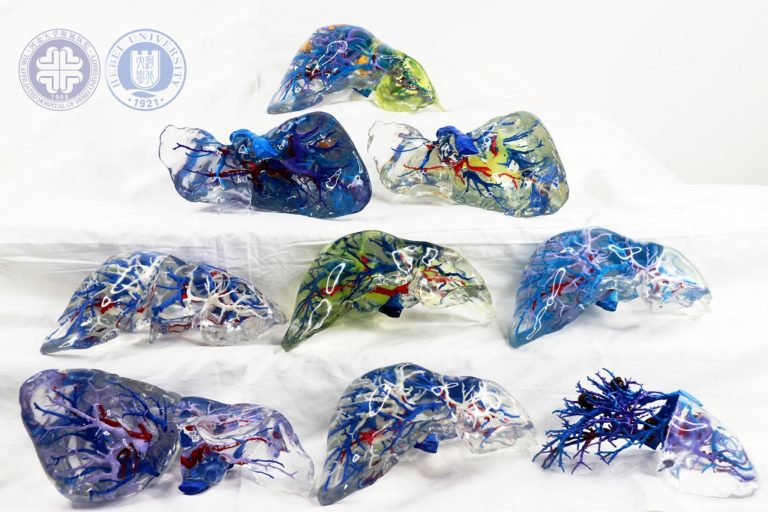 河北大学附属医院开发低成本，高精度的3D打印特异性肝脏模型