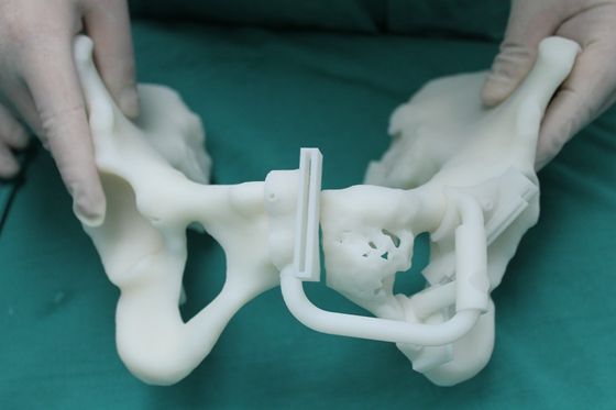 “甘肃省骨科3D打印工程研究中心”获准立项建设