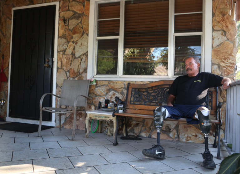 爱心爆棚！佛罗里达州男子从e-NABLE收到新的3D打印手