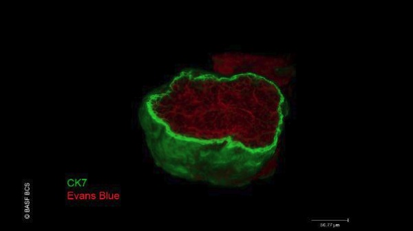 巴斯夫和CTIBiotech公布3D人类皮脂腺技术的首个成果