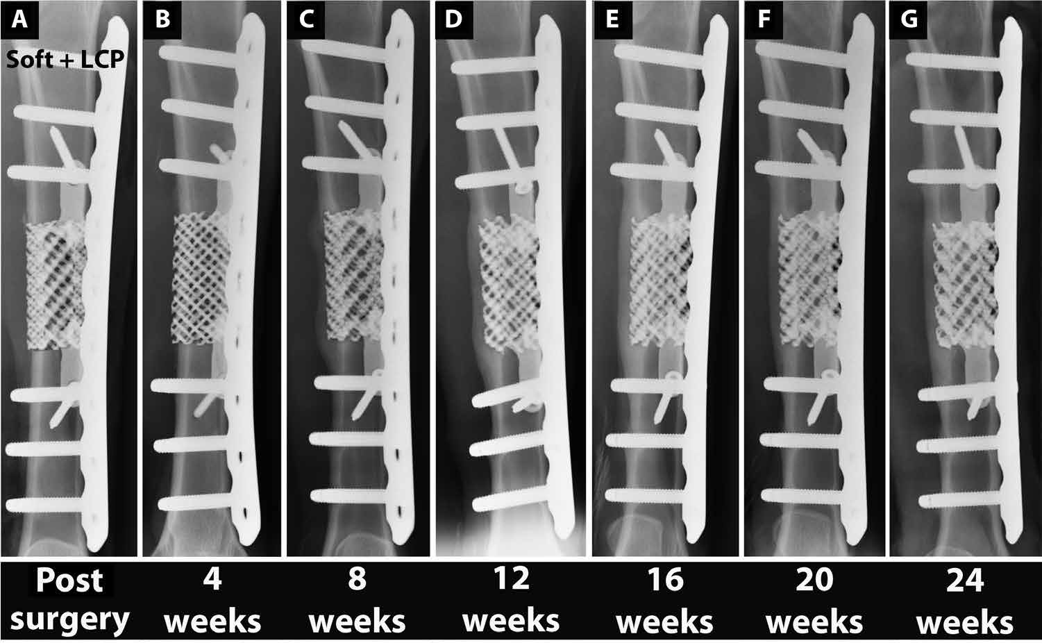 研究发现：特殊情况下，3D打印钛网支架比目前的骨移植治疗更好