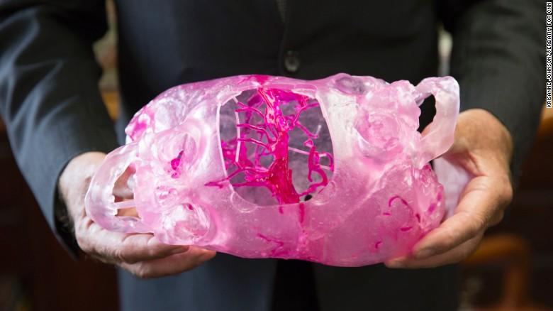 3D Systems和Stryker合作开发虚拟手术计划分销合作伙伴