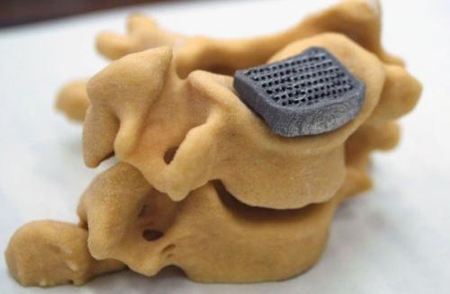 山西大医院骨科于近日成立3D打印研究室