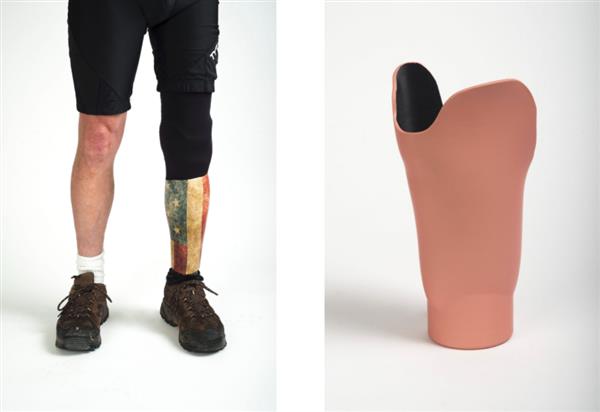 南卡罗来纳州的Extremiti3D收到20万美元，用于开发3D打印假牙插座