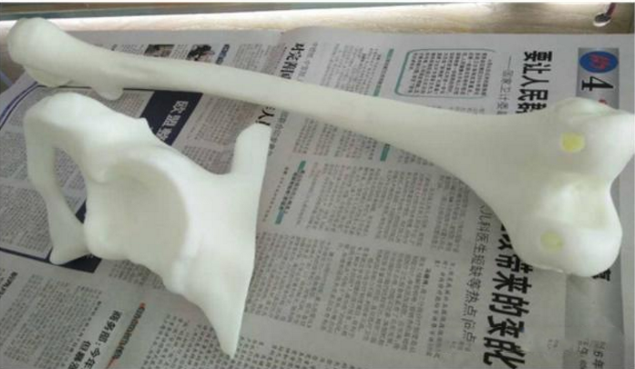 内蒙古3D打印创新中心为国际蒙医院打印术前盆骨、股骨等模型