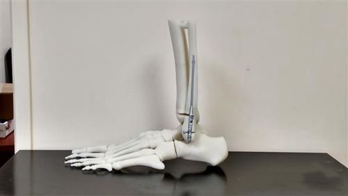 南京大学医学3D打印研究所致力生物3D打印修复患者骨损伤