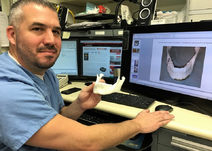 3D打印病人特异性解剖模型给医生和病人带来很大帮助