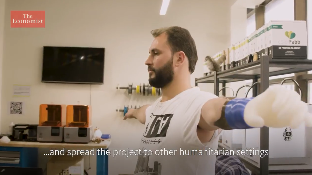 点赞！无国界医生试用3D打印假肢以帮助叙利亚截肢者