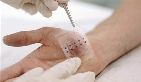 阿根廷研究人员为糖尿病患者开发新的3D生物印花伤口敷料