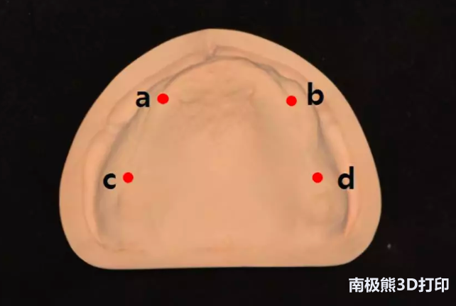 与磨制和注射成型假牙相比，3D打印假牙如何叠加？