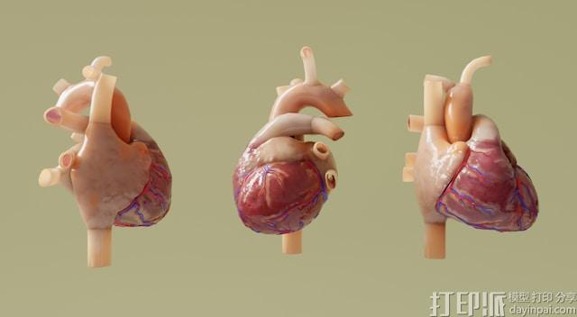 医疗领域的3D打印革命 从心脏模型到个性化手术方案