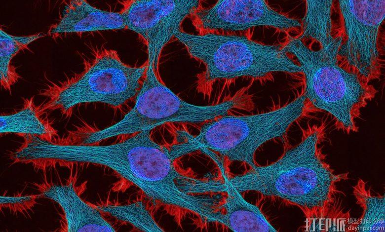 加拿大医生如何用3D打印技术革新癌症治疗