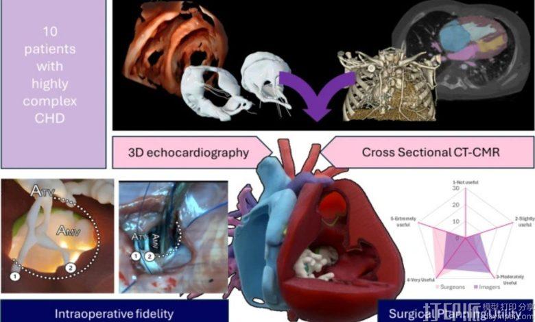 多伦多病童医院研究：多模态融合3D打印心脏模型获外科医生更高评分